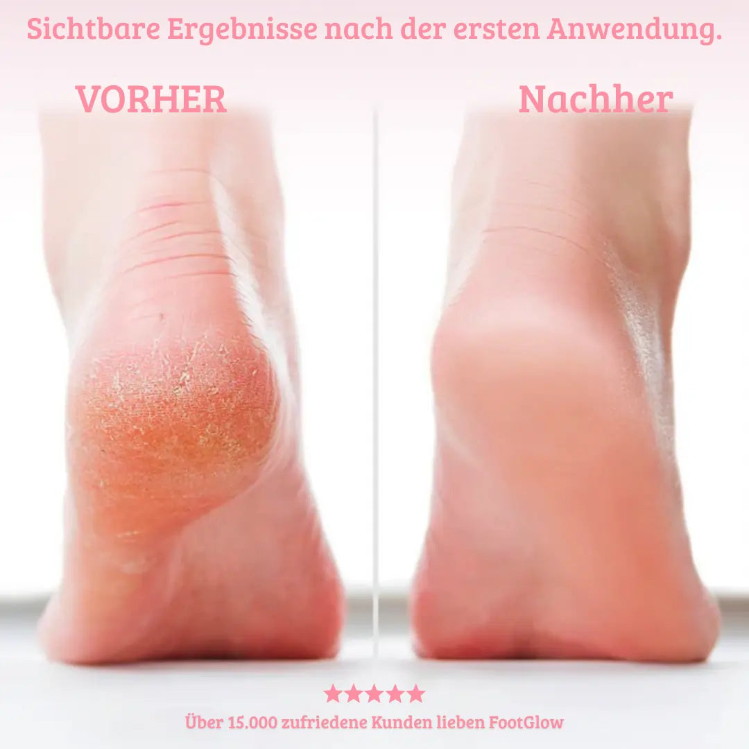 FootGlow - Schöne Füße in nur 5 Minuten